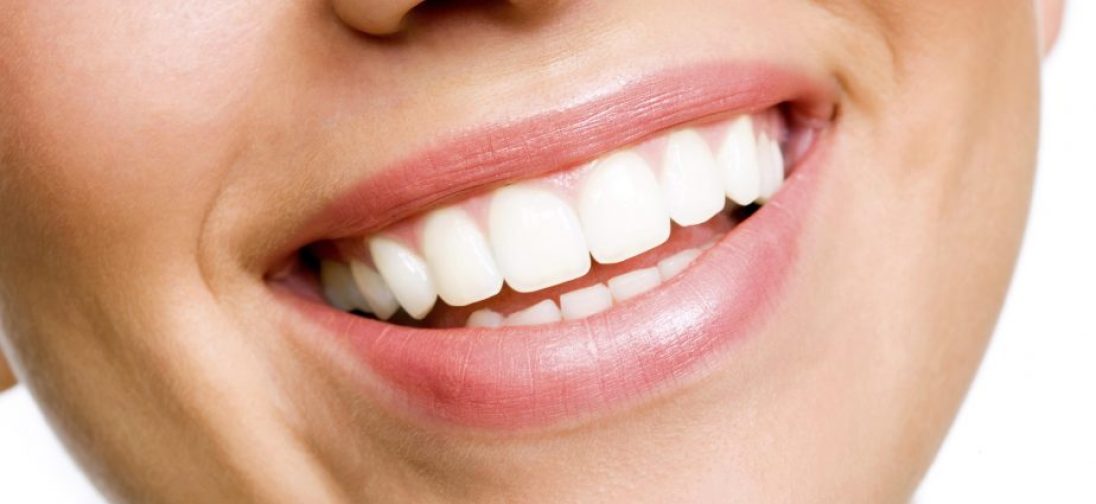 white-teeth-925x425